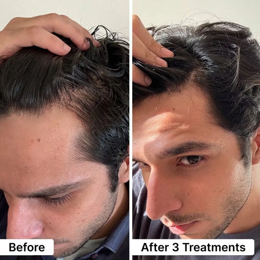 AeroxLabs® Hair Regrowth 24K Gold-Plated Micro-Infusion